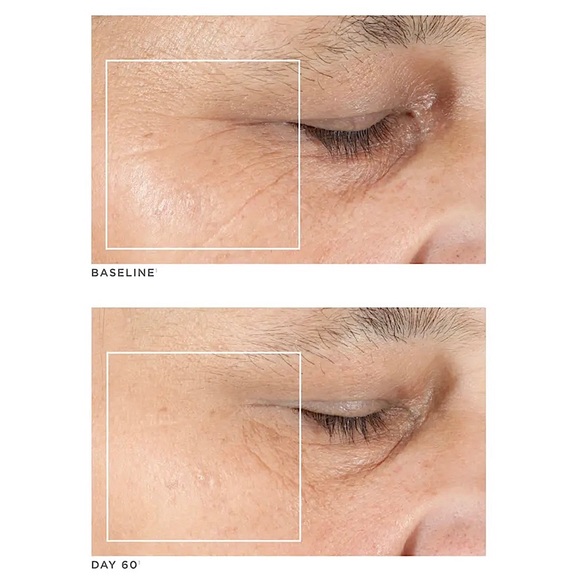 NUFACE TRINITY COMPLETE FACIAL TONING KIT - Picture 12 of 12